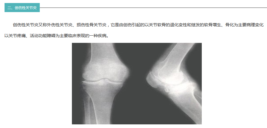 guanjiezhihuan_05.jpg