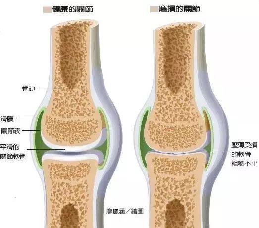 关节响的烦恼……