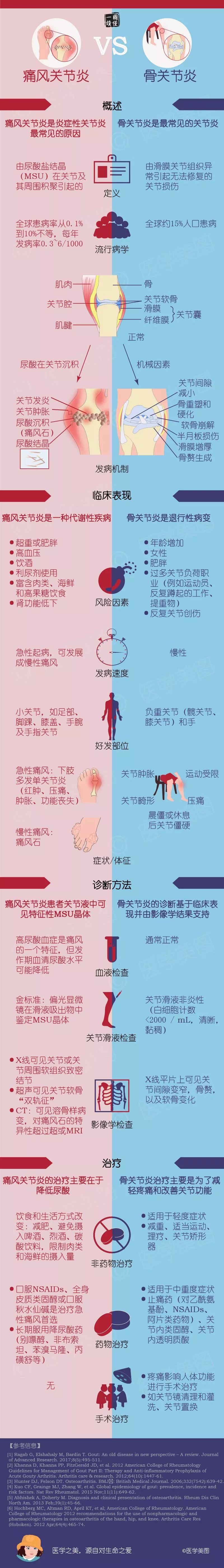 痛风关节炎和骨关节炎的区别