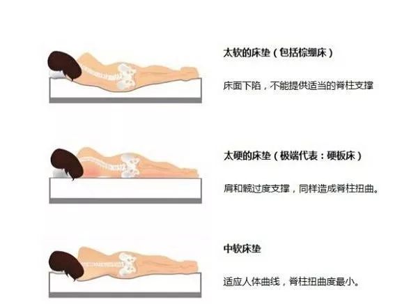 一篇让你彻底明白“腰疼”的好文章！