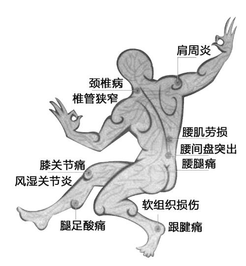 这些身体部位如果疼痛，您可以看看骨科了！