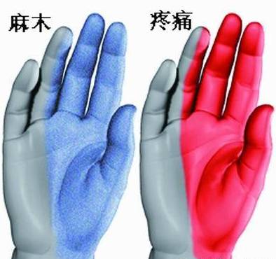 半夜“手麻”？快看看自己是不是得了这种病