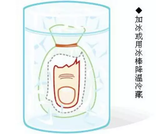 三大因素影响断指再植的成功率