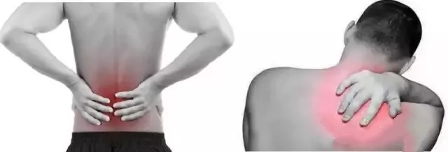 腰背痛也可能是肌筋膜炎