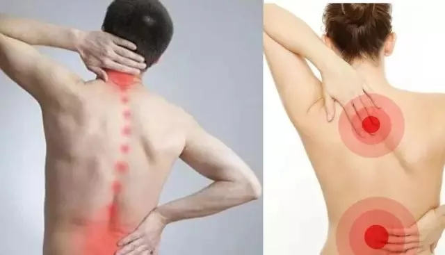 腰背痛也可能是肌筋膜炎