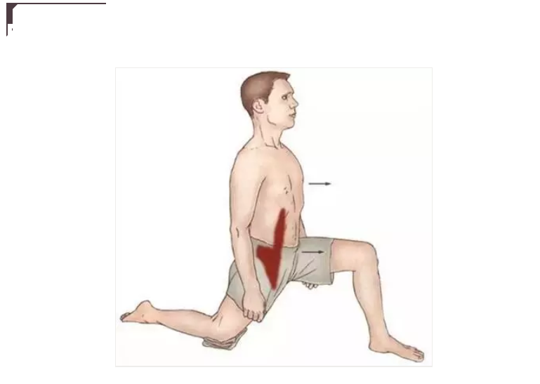大腹便便引起的腰疼？其实是下交叉综合症在作怪