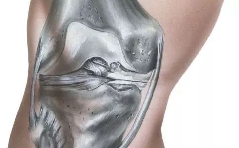 腰肌劳损的鉴别方法 如何预防比较好 图片